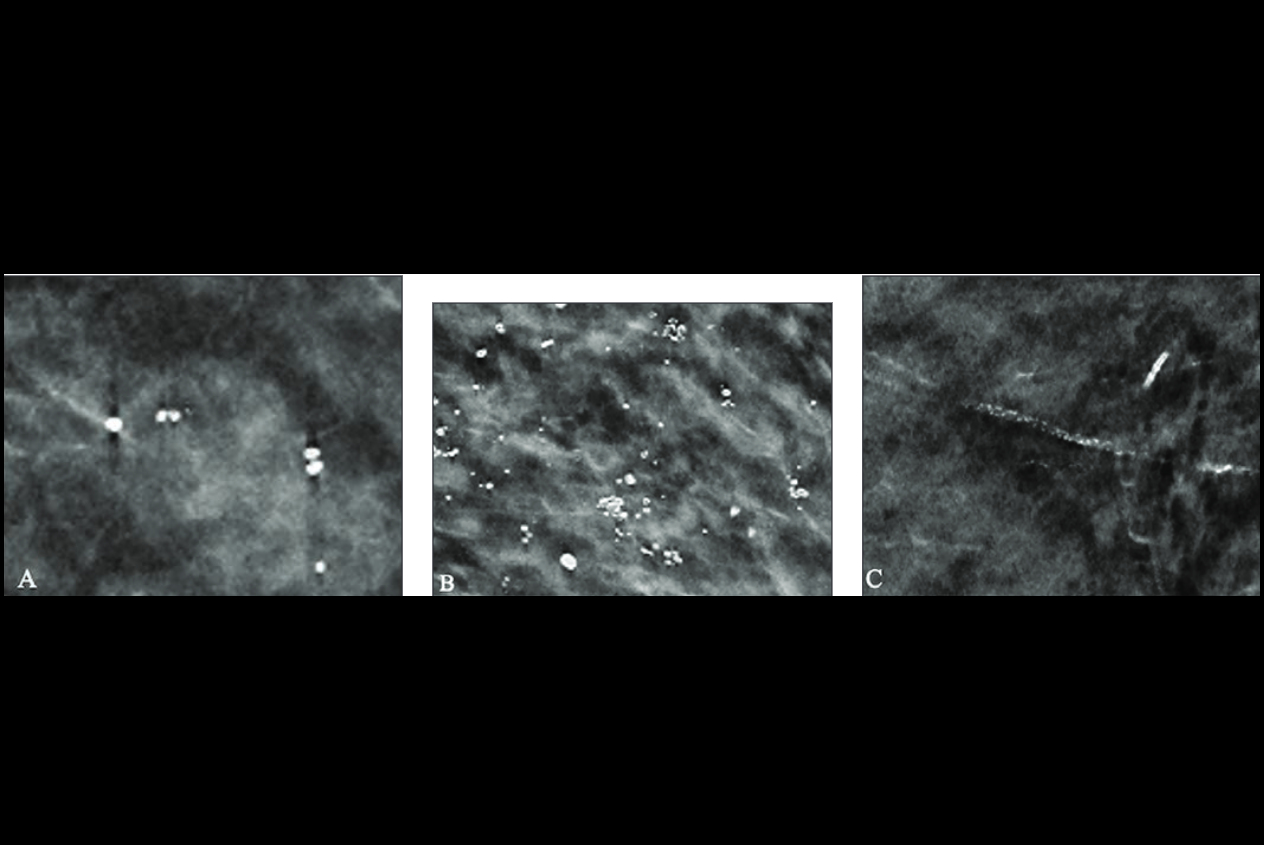 2025 10 02 Shahrvini Ai Vs Radiologist False Positives Thumbnail