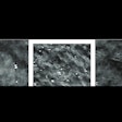 2025 10 02 Shahrvini Ai Vs Radiologist False Positives Thumbnail