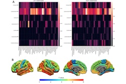 2025 10 07 Free Water Fraction Thumbnail