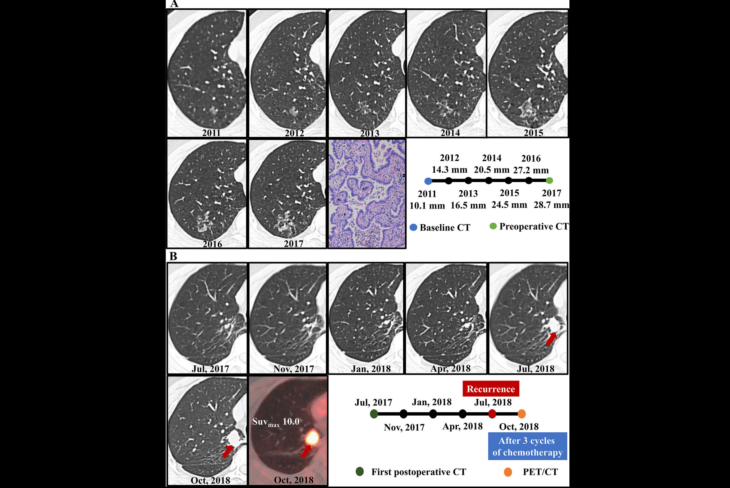 2025 10 07 Radiology Liu Figure4 Thumbnail2