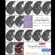2025 10 07 Radiology Liu Figure4 Thumbnail2