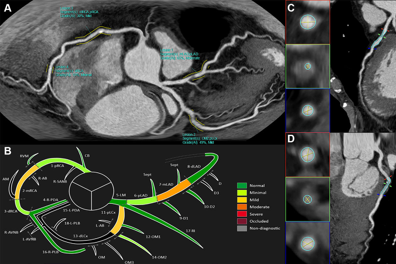 2025 10 09 Rad Cardiothor Imag Fari Figure4 Thumbnail