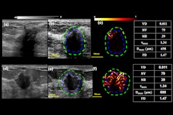 2025 10 14 Breast Qhdmi Ultrasound Thumbnail