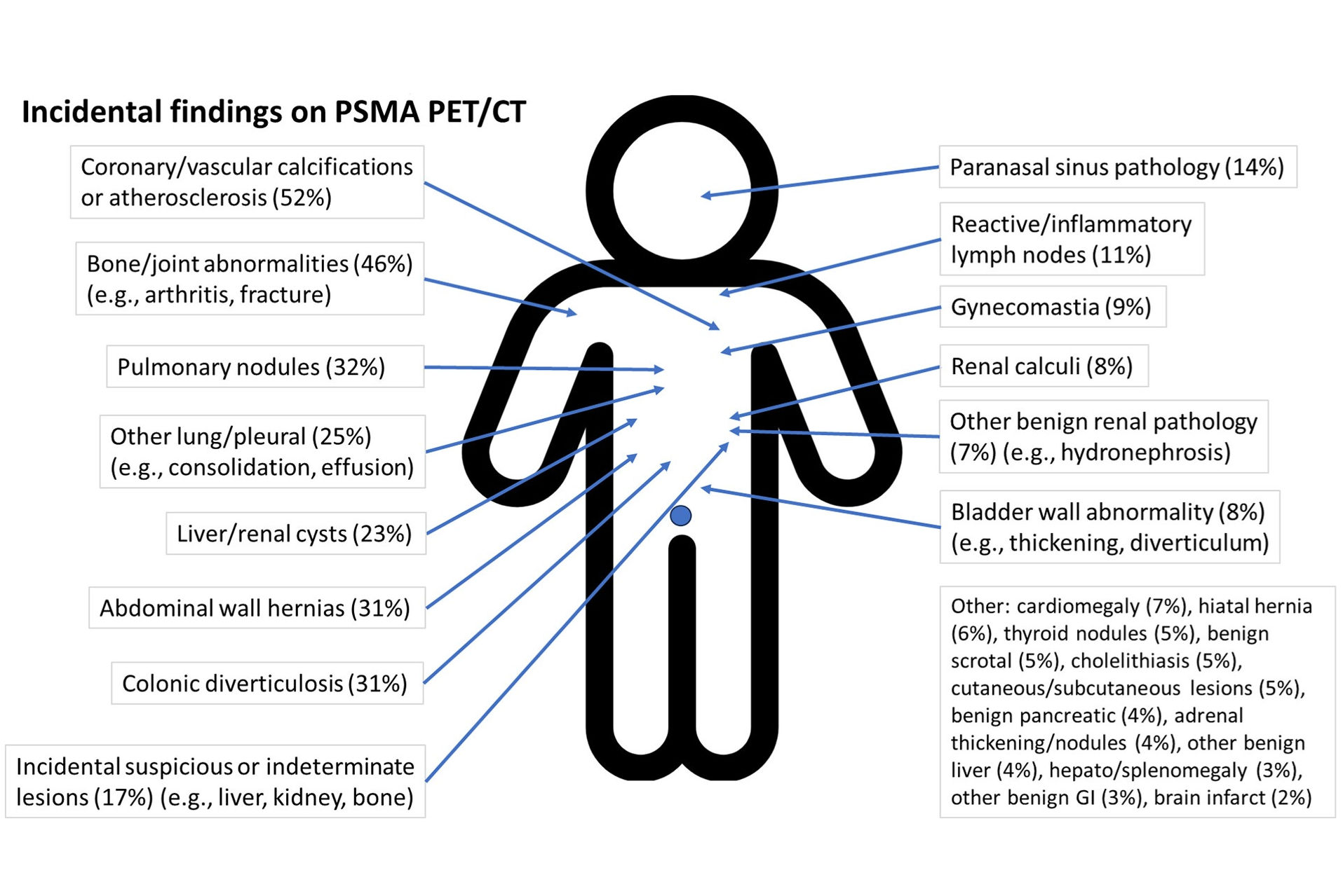2025 10 14 Incidental Findings Psma Pet Ct Thumbnail