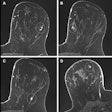2025 10 14 Radiology Preop Mri Birads Thumbnail