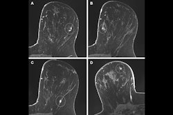 2025 10 14 Radiology Preop Mri Birads Thumbnail