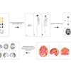 2025 10 16 Chemo Brain Thumbnail
