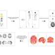 2025 10 16 Chemo Brain Thumbnail