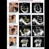 2025 10 18 Airmj Shutes Pocus Transport Team Thumbnail