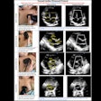 2025 10 18 Airmj Shutes Pocus Transport Team Thumbnail