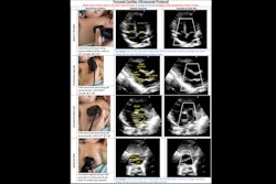 2025 10 18 Airmj Shutes Pocus Transport Team Thumbnail