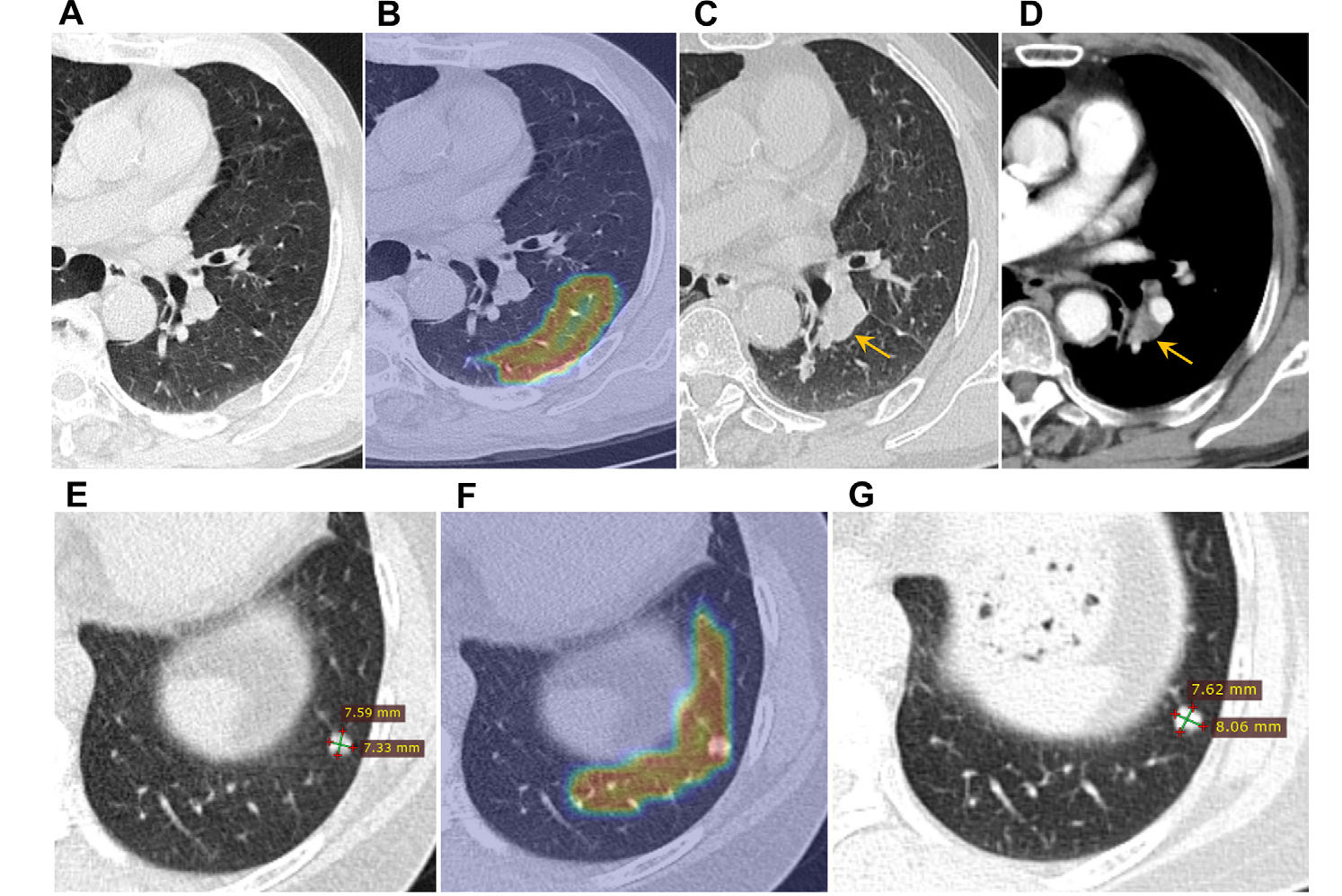 2025 10 21 Radiology Lin Figure6 Thumbnail