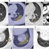 2025 10 21 Radiology Lin Figure6 Thumbnail