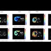 2025 10 24 Jmri Said Fig2 Thumbnail