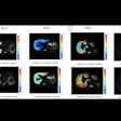 2025 10 24 Jmri Said Fig2 Thumbnail