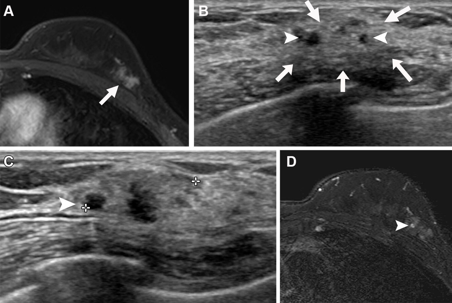 2025 10 7 Radiology Ultrasound Nonmass Lesions Thumbnail