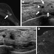 2025 10 7 Radiology Ultrasound Nonmass Lesions Thumbnail