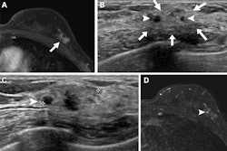 2025 10 7 Radiology Ultrasound Nonmass Lesions Thumbnail