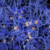 Alzheimers Amyloid