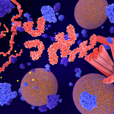 Alzheimers Tau Tangles 400