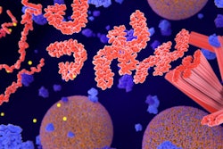 Alzheimers Tau Tangles 400