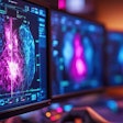 Breast Imaging Computer Screen Thumbnail