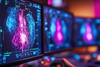 Breast Imaging Computer Screen Thumbnail