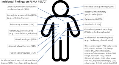 A diagram showing the frequency of incidental findings in 111 prostate-specific membrane antigen (PSMA) PET/CT reports. GI = gastrointestinal.