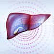 Liver Gallbladder 400