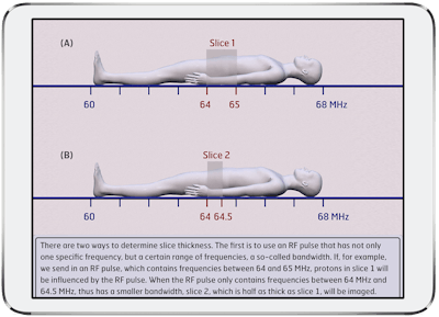 MRI Made Easy... well almost is an animated app designed to serve as an introduction to MR physics.