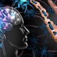Multiple Sclerosis Nerve Disorder Brain Adobe Freshidea