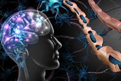 Multiple Sclerosis Nerve Disorder Brain Adobe Freshidea
