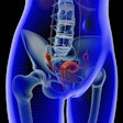 Uterus Pelvic 400