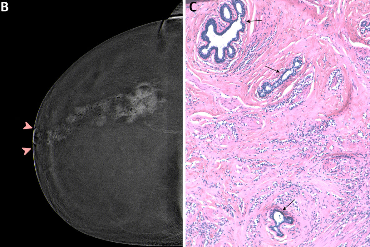 2025 11 04 Images Radiol251350fig2 Thumbnail