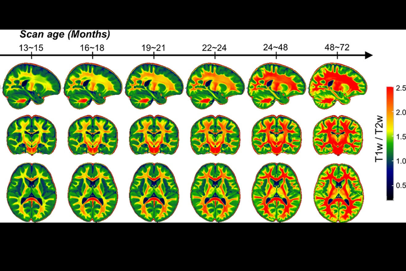 2025 11 04 Myelin Thumbnail