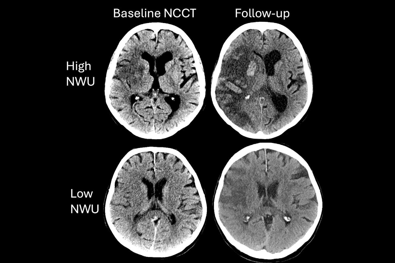 2025 11 04 Radiology Broocks Fig3 Thumbnail