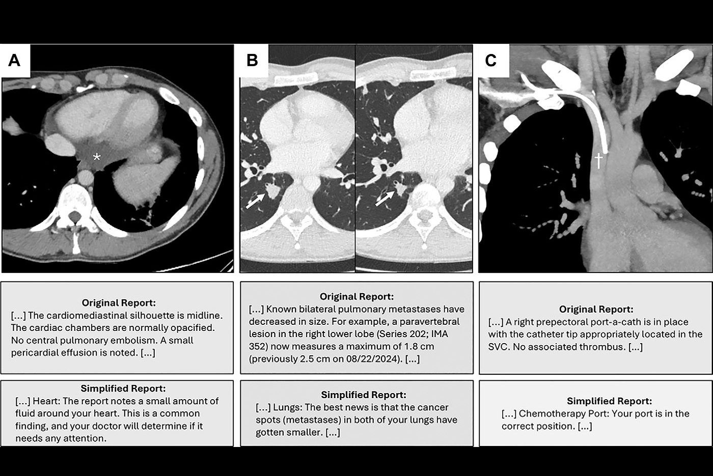 2025 11 18 Ll Ms Ct Report Figure6 Thumbnail