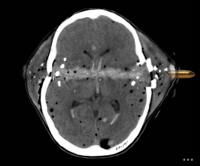 2025 11 20 33 Gunshot