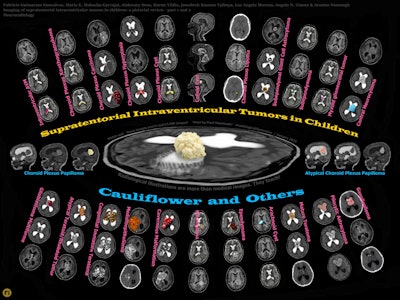 2025 11 20 Cauliflower