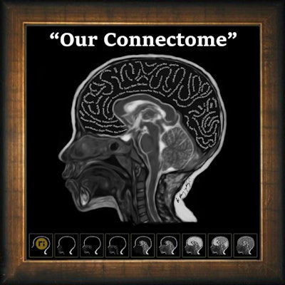 2025 11 20 Our Connectome2