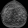 2025 11 24 Destounis Breast Cancer Thumbnail