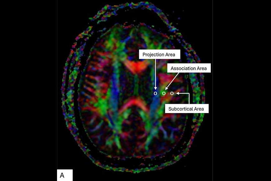 2025 11 24 Fighter Image Thumbnail
