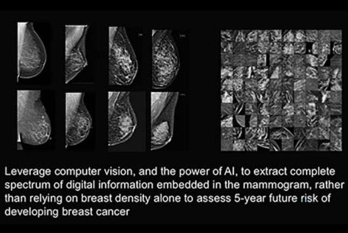 2025 11 24 Image Only Ai Model Breast Cancer Thumbnail