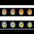 2025 11 25 Amyloid Positive Scans Figure 5 Thumbnail