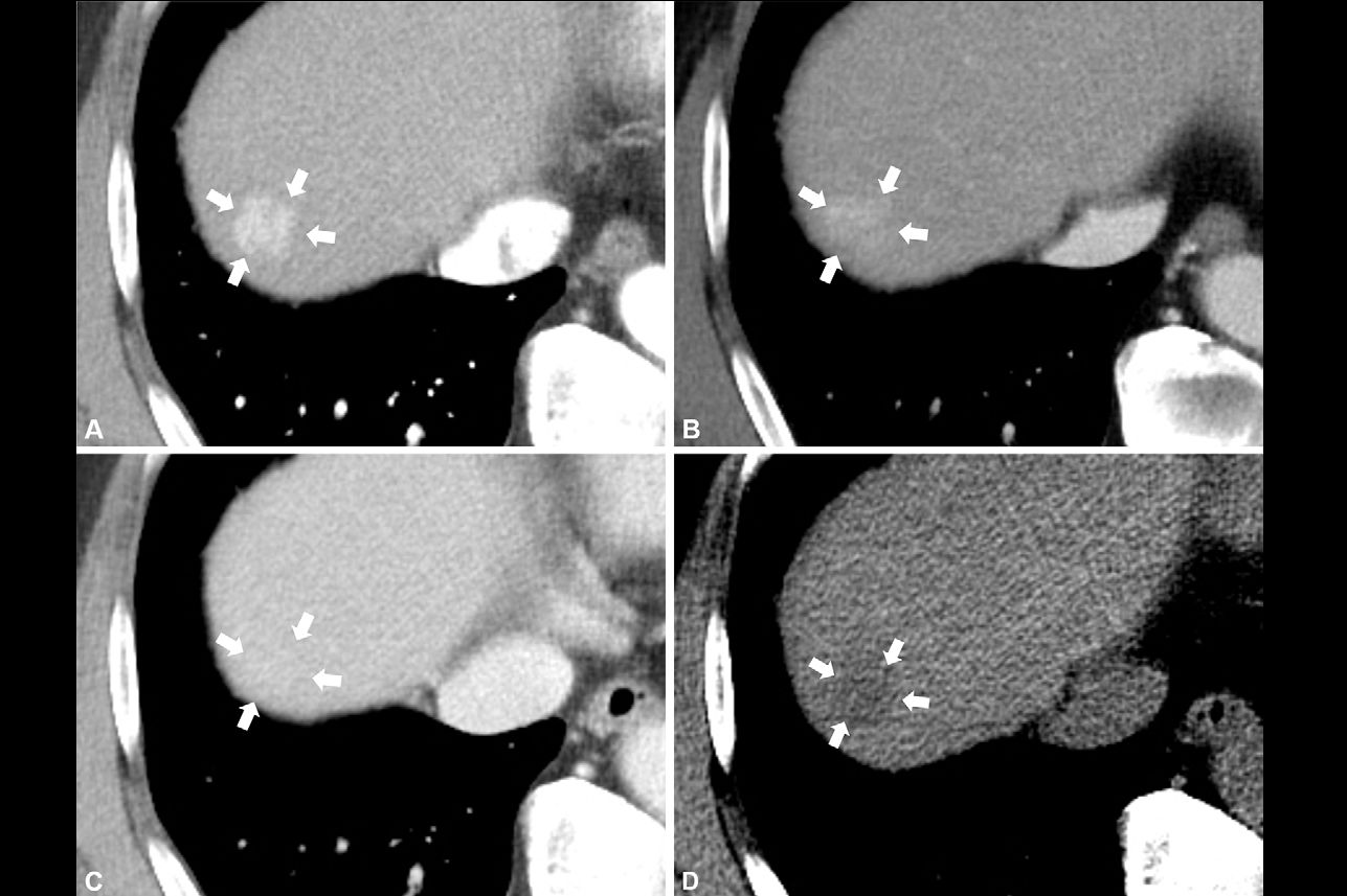 2025 11 25 Radiology Park Figure2 Thumbnail