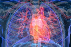 Am 2020 01 04 00 31 7725 Heart Attack Disease 3 D 400