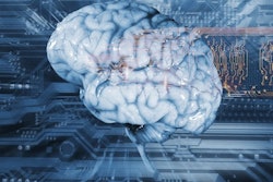 Artificial Intelligence Ai Brain 400