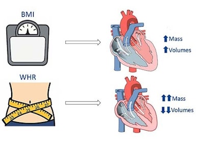 Pictogram showing the results of the research. An increase in waist-to-hip ratio (WHR) is associated with a higher left ventricular (LV) mass and lower ventricular volumes. Its association with right ventricular (RV) volumes is weaker in women than in men. An increase in body mass index (BMI) is associated with ventricular dilatation and a higher LV mass, although this relationship is also weaker in women.