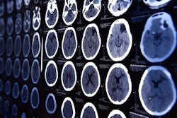 Ct Head Brain Adobe Nimon T