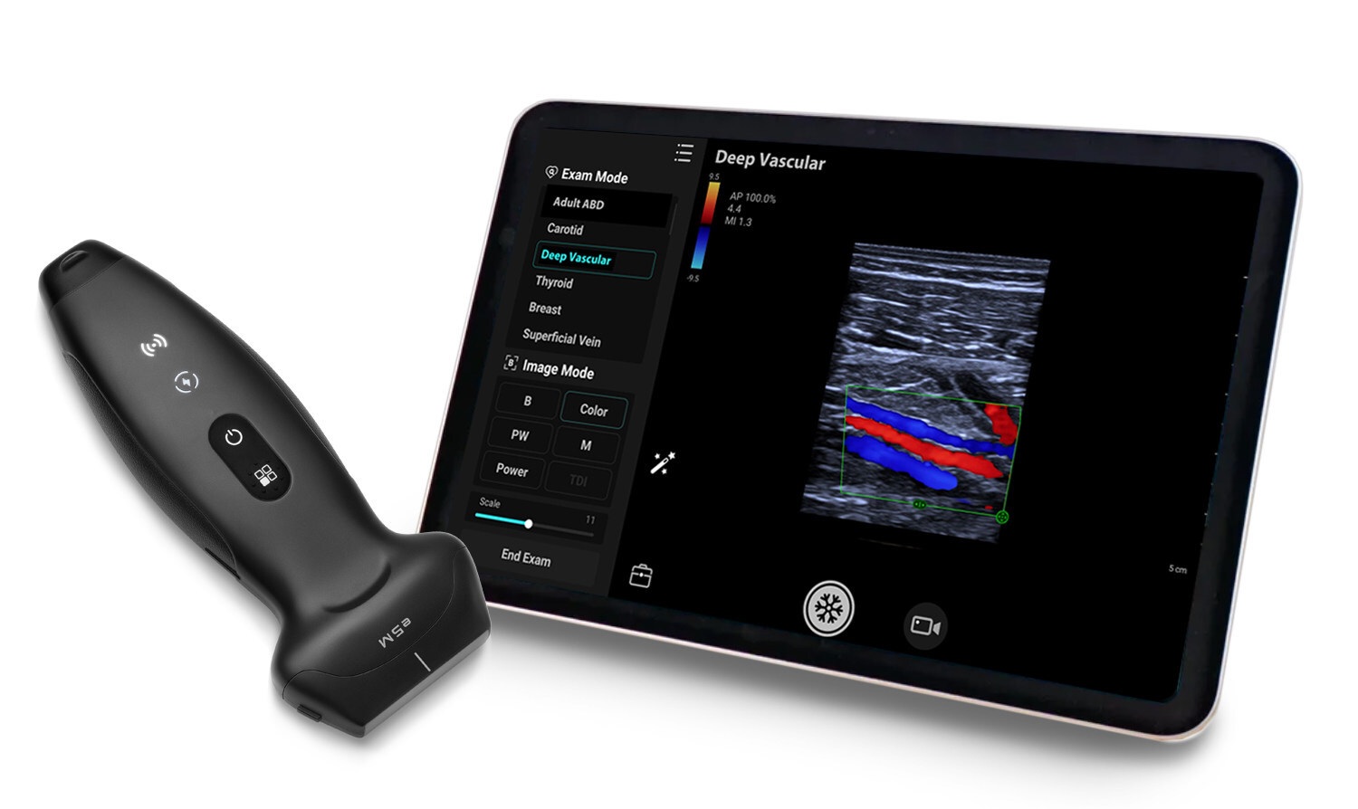 Mindray&apos;s TE Air e5M ultrasound system.